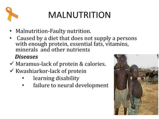 MALNUTRITION
• Malnutrition-Faulty nutrition.
• Caused by a diet that does not supply a persons
with enough protein, essential fats, vitamins,
minerals and other nutrients
Diseases
 Maramus-lack of protein & calories.
 Kwashiarkor-lack of protein
• learning disability
• failure to neural development
 