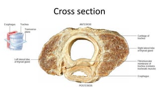 Cross section
 