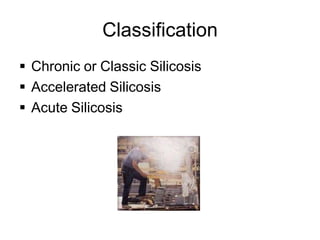 Classification
 Chronic or Classic Silicosis
 Accelerated Silicosis
 Acute Silicosis
 
