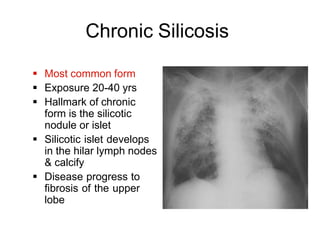 Chronic Silicosis
 Most common form
 Exposure 20-40 yrs
 Hallmark of chronic
form is the silicotic
nodule or islet
 Silicotic islet develops
in the hilar lymph nodes
& calcify
 Disease progress to
fibrosis of the upper
lobe
 