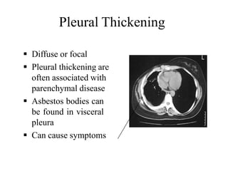 Pleural Thickening
 Diffuse or focal
 Pleural thickening are
often associated with
parenchymal disease
 Asbestos bodies can
be found in visceral
pleura
 Can cause symptoms
 