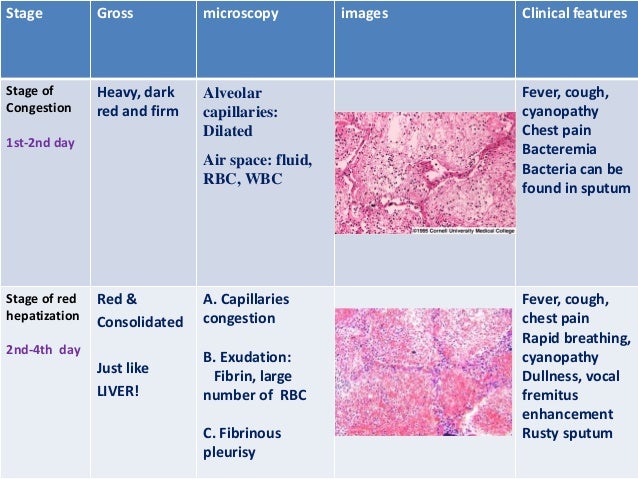 RESPIRATORY SYSTEM: PATHOLOGY OF PNEUMONIAS