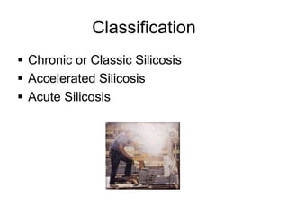 Classification
 Chronic or Classic Silicosis
 Accelerated Silicosis
 Acute Silicosis
 