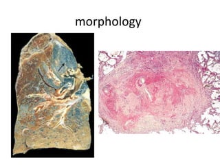 morphology
 