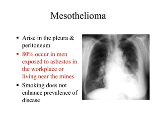 Mesothelioma
 Arise in the pleura &
peritoneum
 80% occur in men
exposed to asbestos in
the workplace or
living near the mines
 Smoking does not
enhance prevalence of
disease
 