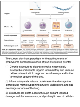 The current dominant paradigm for the pathogenesis of
emphysema comprises a series of four interrelated events:
(1) Chronic exposure to cigarette smoke in genetically
susceptible individuals triggers in
fl
ammatory and immune
cell recruitment within large and small airways and in the
terminal air spaces of the lung.
(2) In
fl
ammatory cells release proteinases that damage the
extracellular matrix supporting airways, vasculature, and gas
exchange surfaces of the lung.
(3) Structural cell death occurs through oxidant-induced
damage, cellular senescence, and proteolytic loss of cellular-
 