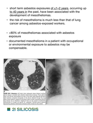 - short term asbestos exposures of ≤1–2 years, occurring up
to 40 years in the past, have been associated with the
development of mesotheliomas.
- the risk of mesothelioma is much less than that of lung
cancer among asbestos-exposed workers.
• >80% of mesotheliomas associated with asbestos
exposure
• documented mesothelioma in a patient with occupational
or environmental exposure to asbestos may be
compensable.
■ 2l SILICOSIS
 