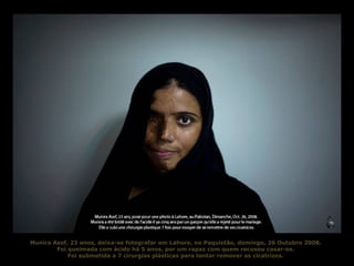Munira Asef, 23 anos, deixa-se fotografar em Lahore, no Paquistão, domingo, 26 Outubro 2008. Foi queimada com ácido há 5 anos, por um rapaz com quem recusou casar-se. Foi submetida a 7 cirurgias plásticas para tentar remover as cicatrizes. 