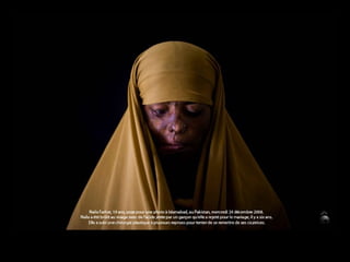 Naila Farhat, 19 anos, deixa-se fotografar em Islamabad, no Paquistão, 4ªfeira, 24 Dezembro 2008. Há 6 anos recusou casar-se com o rapaz que veio a queimar-lhe o rosto com ácido. Foi submetida a várias cirurgias para tentar remover as cicatrizes. 