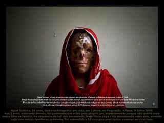Najaf Sultana, 16 anos, deixa-se fotografar em casa, em Lahore, no Paquistão, 4ªfeira, 9 Julho 2008. Aos 5 anos, enquanto dormia, foi queimada com ácido pelo próprio pai, supostamente porque não queria mais outra filha na família. Na sequência de ter sido incendiada, Najaf ficou cega e foi abandonada pelos pais, vivendo hoje com outros familiares próximos. Foi submetida a 15 cirurgias para tentar remover as cicatrizes. 