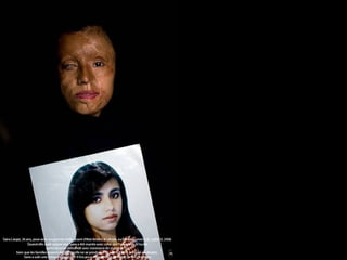 Saira, 26 anos, posa com uma foto anterior dela, em Lahore, no Paquistão, 4ªfeira, 9 Julho 2008.  Casou aos 15 anos com o homem que mais tarde a queimou com ácido porque insistia que ela tinha que voltar para ele, apesar das famílias de ambos terem acordado que primeiro ela tinha que terminar os estudos. Foi submetida a 9 cirurgias para tentar remover as cicatrizes. 