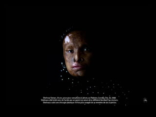 Shehnaz Usman, 36 anos, deixa-se fotografar em Lahore, no Paquistão, domingo, 26 Outubro 2008. Há 5 anos, devido a uma disputa familiar, foi queimada com ácido por um parente seu. Foi submetida a 10 cirurgias plásticas para tentar remover as cicatrizes. 