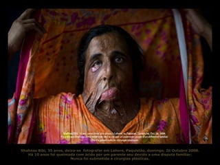 Shahnaz Bibi, 35 anos, deixa-se  fotografar em Lahore, Paquistão, domingo, 26 Outubro 2008. Há 10 anos foi queimada com ácido por um parente seu devido a uma disputa familiar. Nunca foi submetida a cirurgias plásticas. 