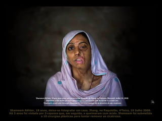 Shameem Akhter, 18 anos, deixa-se fotografar em casa, Jhang, no Paquistão, 4ªfeira, 10 Julho 2008.  Há 3 anos foi violada por 3 rapazes que, em seguida, a queimaram com ácido. Shameem foi submetida  a 10 cirurgias plásticas para tentar remover as cicatrizes. 