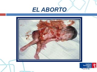 EL ABORTO
 