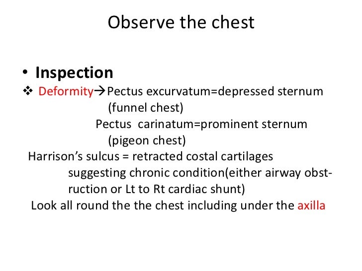 Harrison Sulcus Rickets Radiology Case Radiopaedia Org Translation