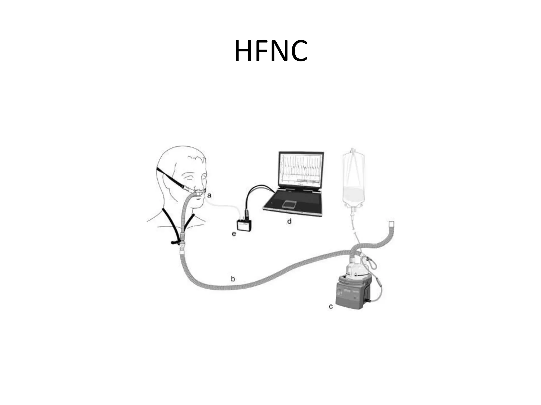 HFNC
 