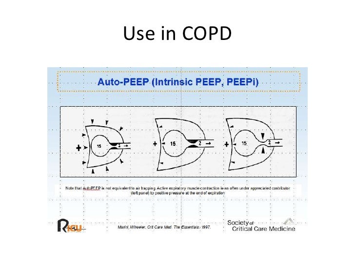 Resp failure talk 9 10 bipap and hfnc emphasis