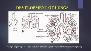 DEVELOPMENT OF LUNGS
The right lung diverges at a lesser angle than left so that aspirated material first enters into the right lung
 