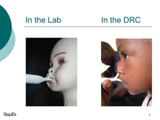 RespiDx: The Respimometer Diagnostic Aid for Childhood Pneumonia | PPTX