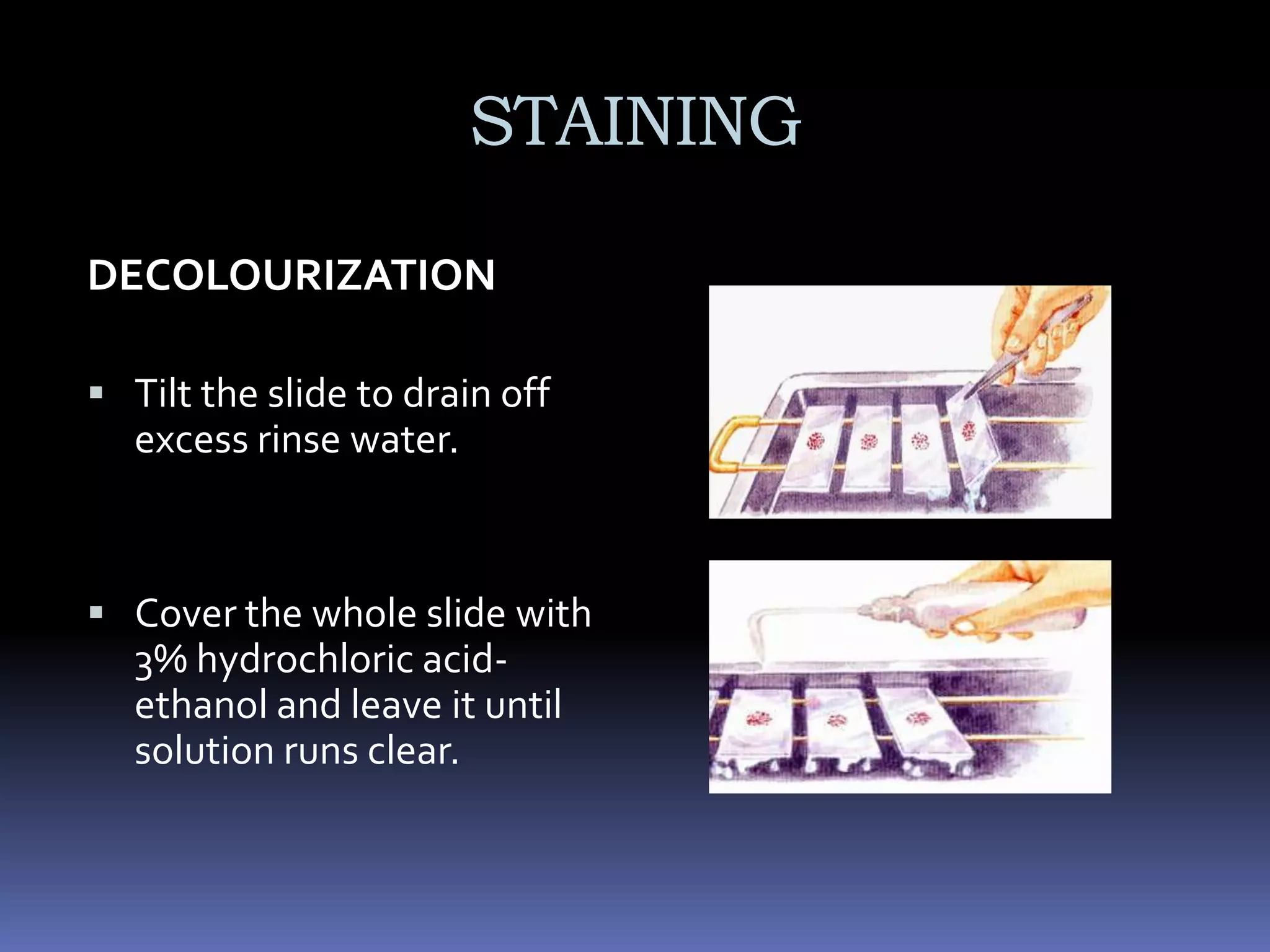 Sputum Collection Schedule forDIAGNOSIS