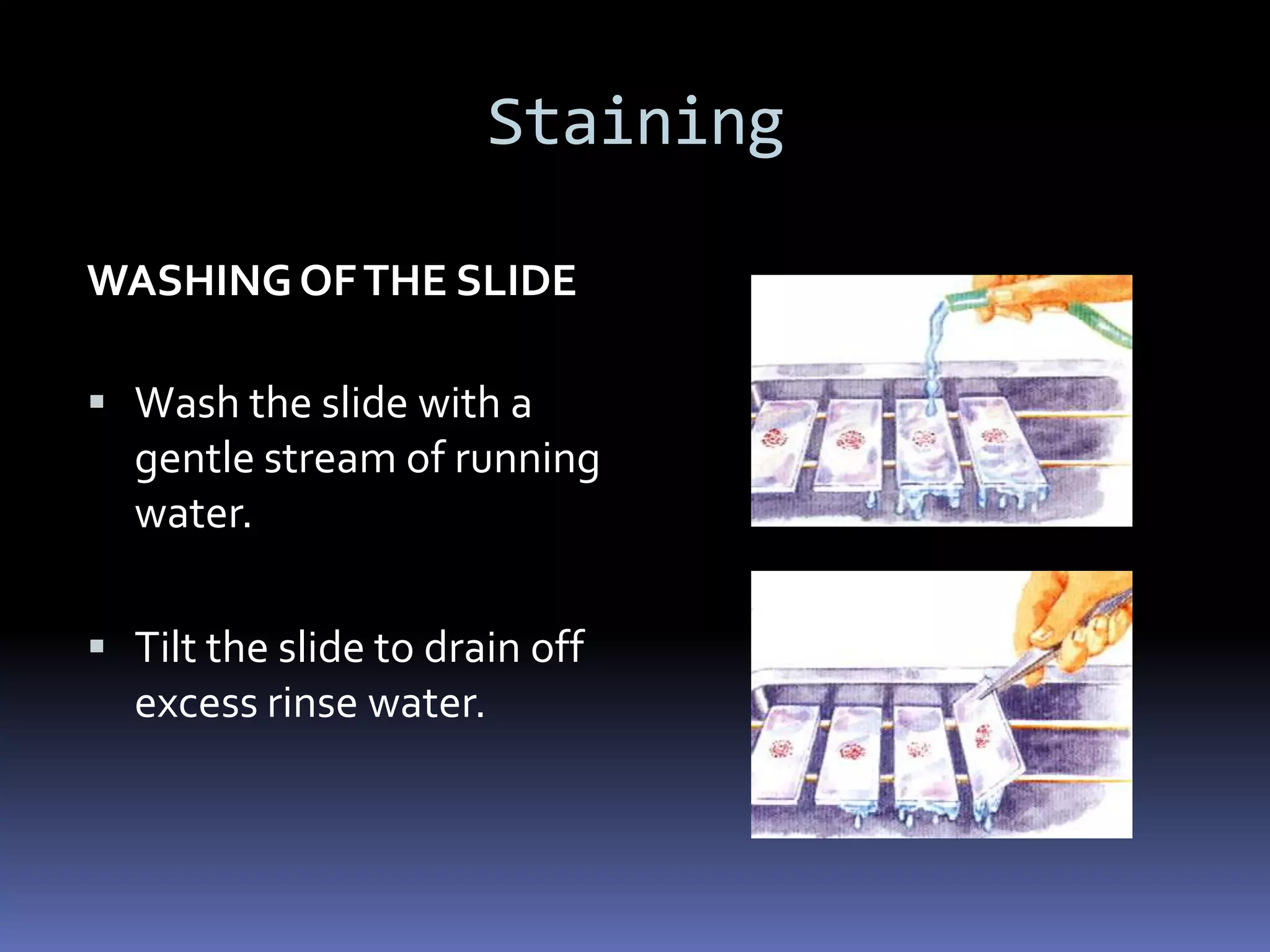 Ideal sputum specimen?MACROSCOPICYellowish