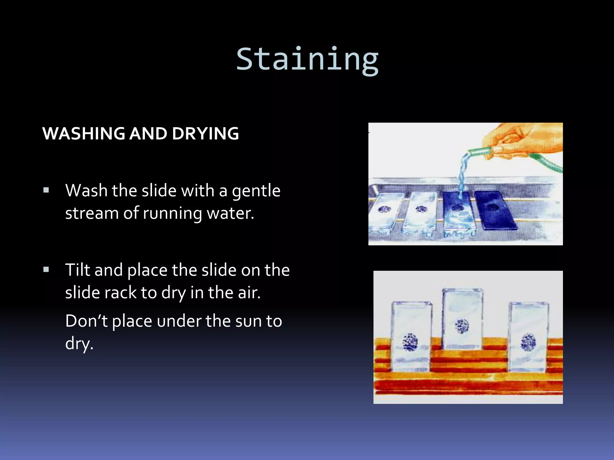 Cheesy materialWhen to collect another set of 3 sputum specimens?When the diagnosis for the sputum microscopy examination is doubtful.When the patient fails to complete his sputum collection within two weeks from the time of the previous collection.
