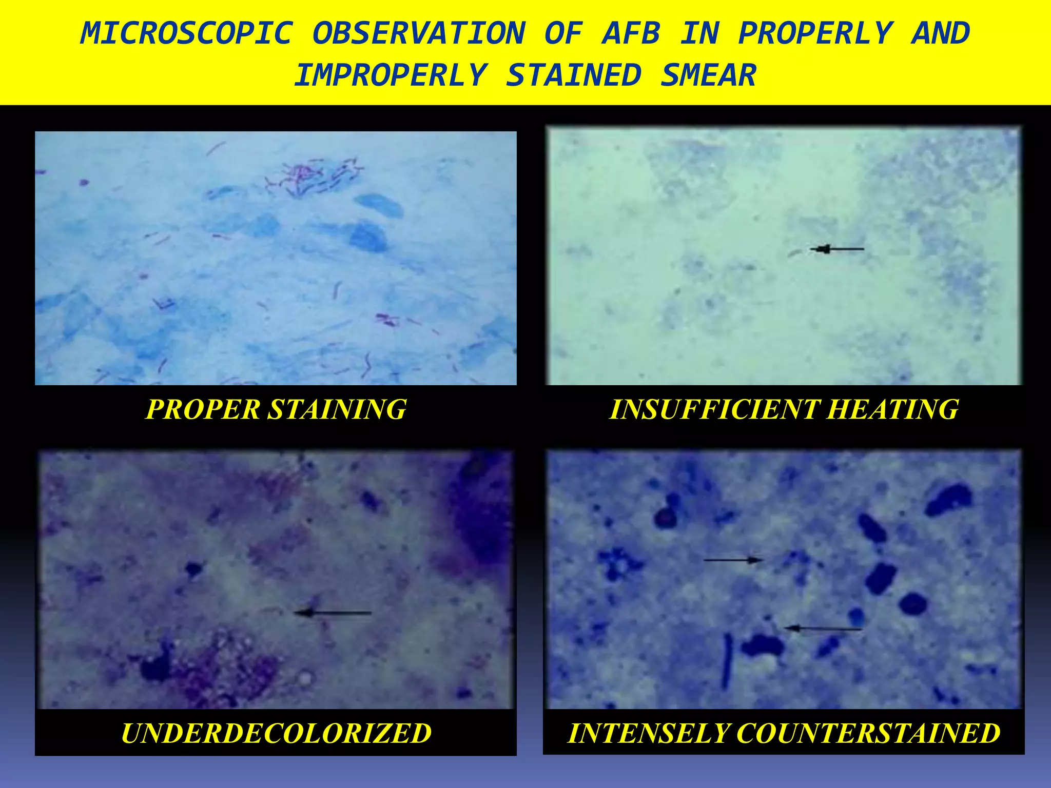 DIRECT SMEAR EXAMINATION(Flow Chart)SMEARING						SPREADING						DRYING						FIXATIONSTAINING						INITIAL STAINING						HEATING						WASHING						DECOLORIZATION						WASHING						COUNTER-STAINING						WASHING						DRYINGMICROSCOPIC OBSERVATION	RECORDING & REPORTING