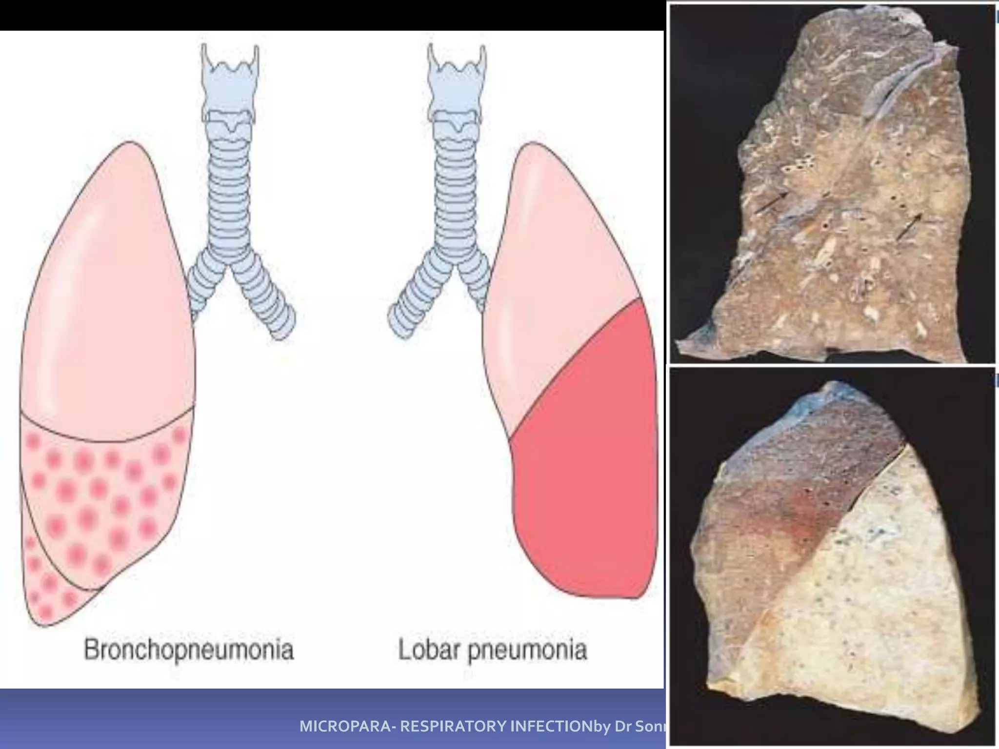SMEARINGDRYINGAllow the smear to dry completely at room temperature. 	Do not dry it under the sun or over the flame.Place used midribs in a bottle with alcohol and sand mixture or Lysol, 	or in a plastic containers and burn them later.