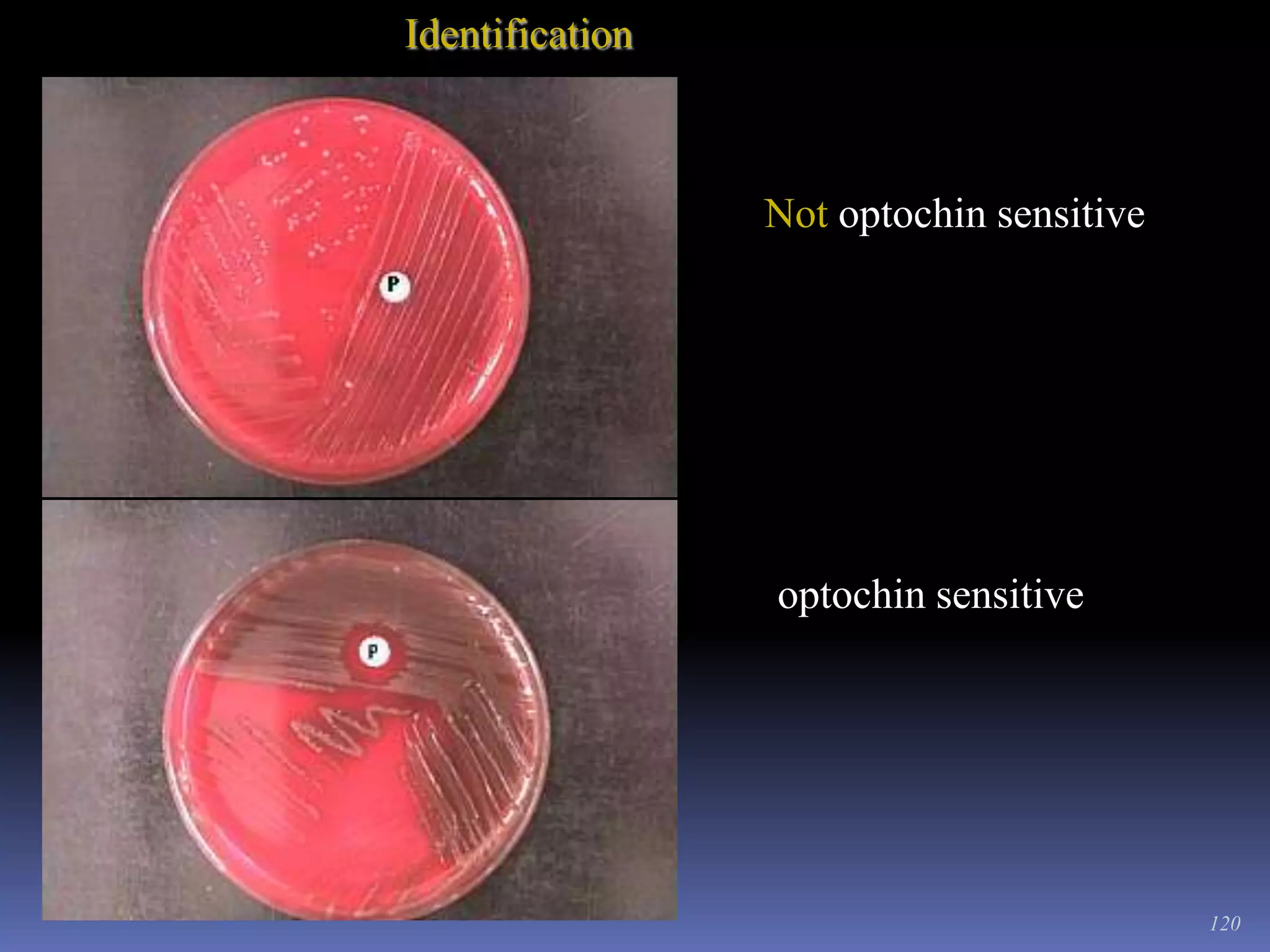 StainingWASHING AND DRYINGWash the slide with a gentle stream of running water.Tilt and place the slide on the slide rack to dry in the air.	Don’t place under the sun to dry.