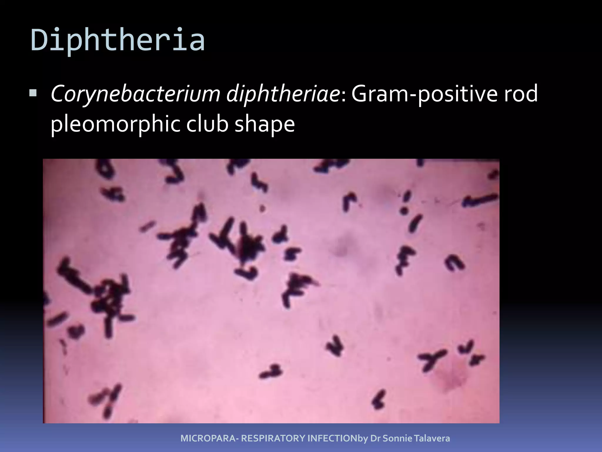 DiphtheriaCorynebacteriumdiphtheriae: Gram-positive rod pleomorphic club shapeMICROPARA- RESPIRATORY INFECTIONby Dr Sonnie Talavera