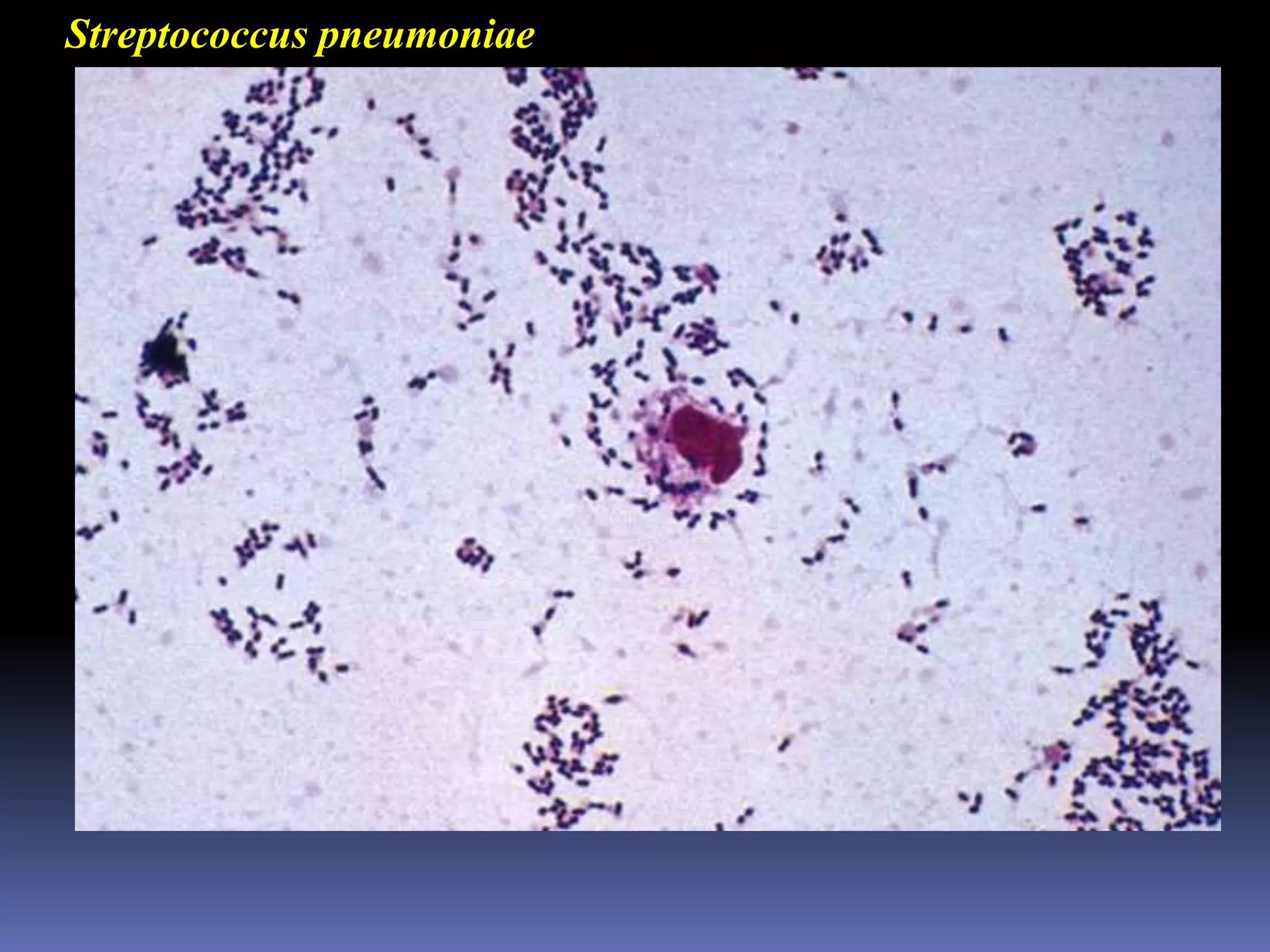 Atypical (walking) pneumoniaMycoplasma pneumoniaLacks peptidoglycan-lactam resistantDisease primarily in young adultsEncounter - inhalation from humanEntry - restricted to mucosal surfaceTerminal adhesin protein (P1)Multiplication - require sterolsDamageInflammationDamage and desquamation of ciliated epitheliumTreatmentsErythromycin, doxycycline, tetracyline