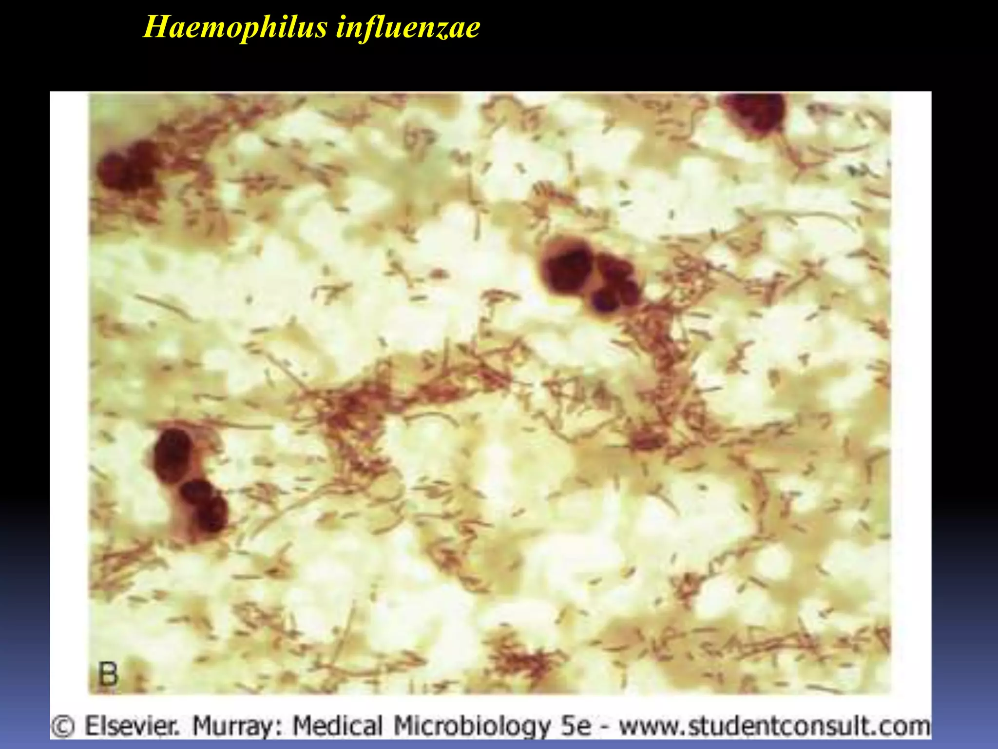 Model for mycoplasma pathogenesis in the lungs
