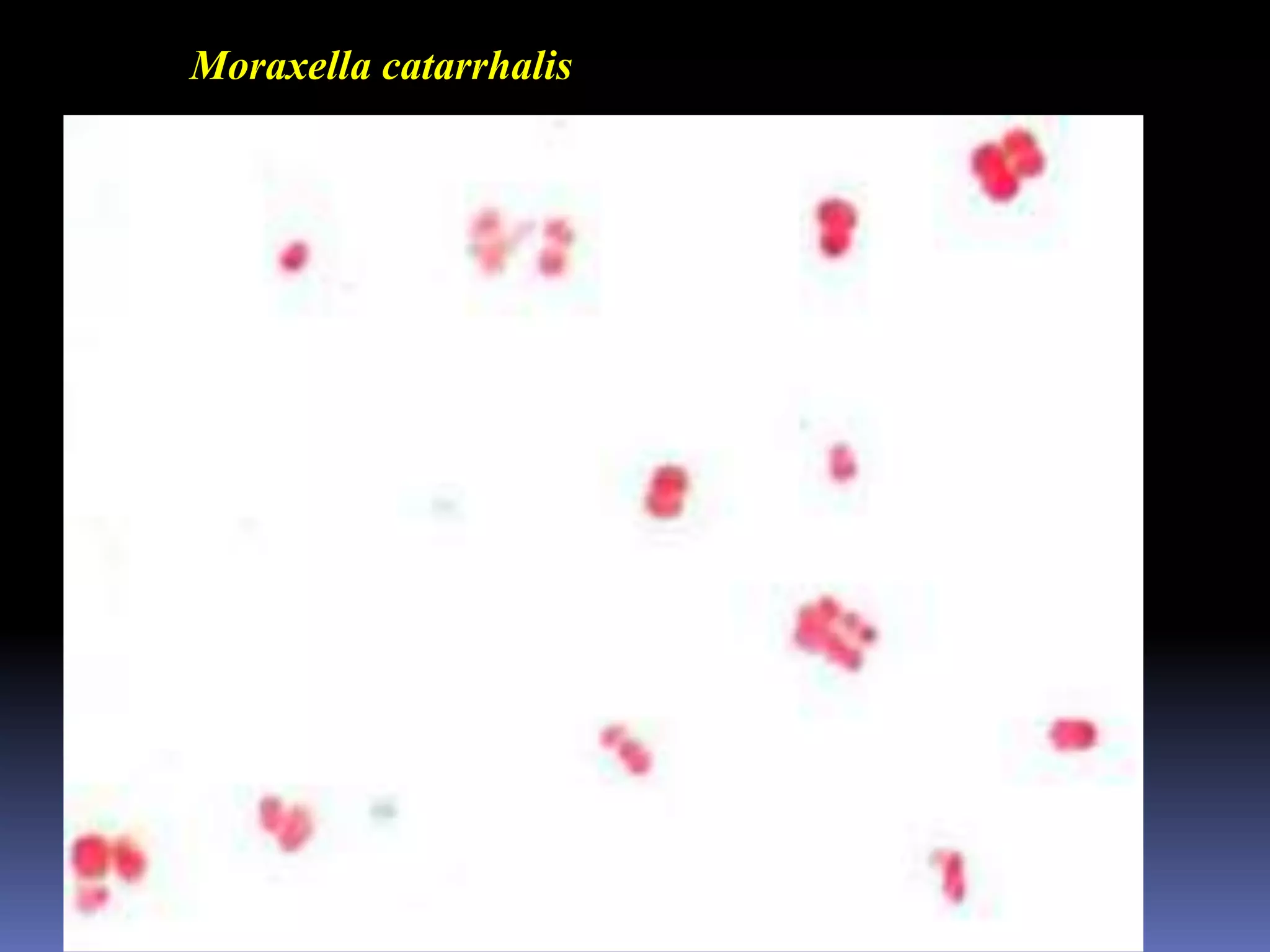 LegionellosisThe disease is caused by the aerobic gram-negative rod Legionellapneumophila.High fever 40.5C, cough  and  general pneumonia symptomsThe bacterium can grow in water, such as air-conditioning cooling towers, and then be disseminated in the air.MICROPARA- RESPIRATORY INFECTIONby Dr Sonnie Talavera