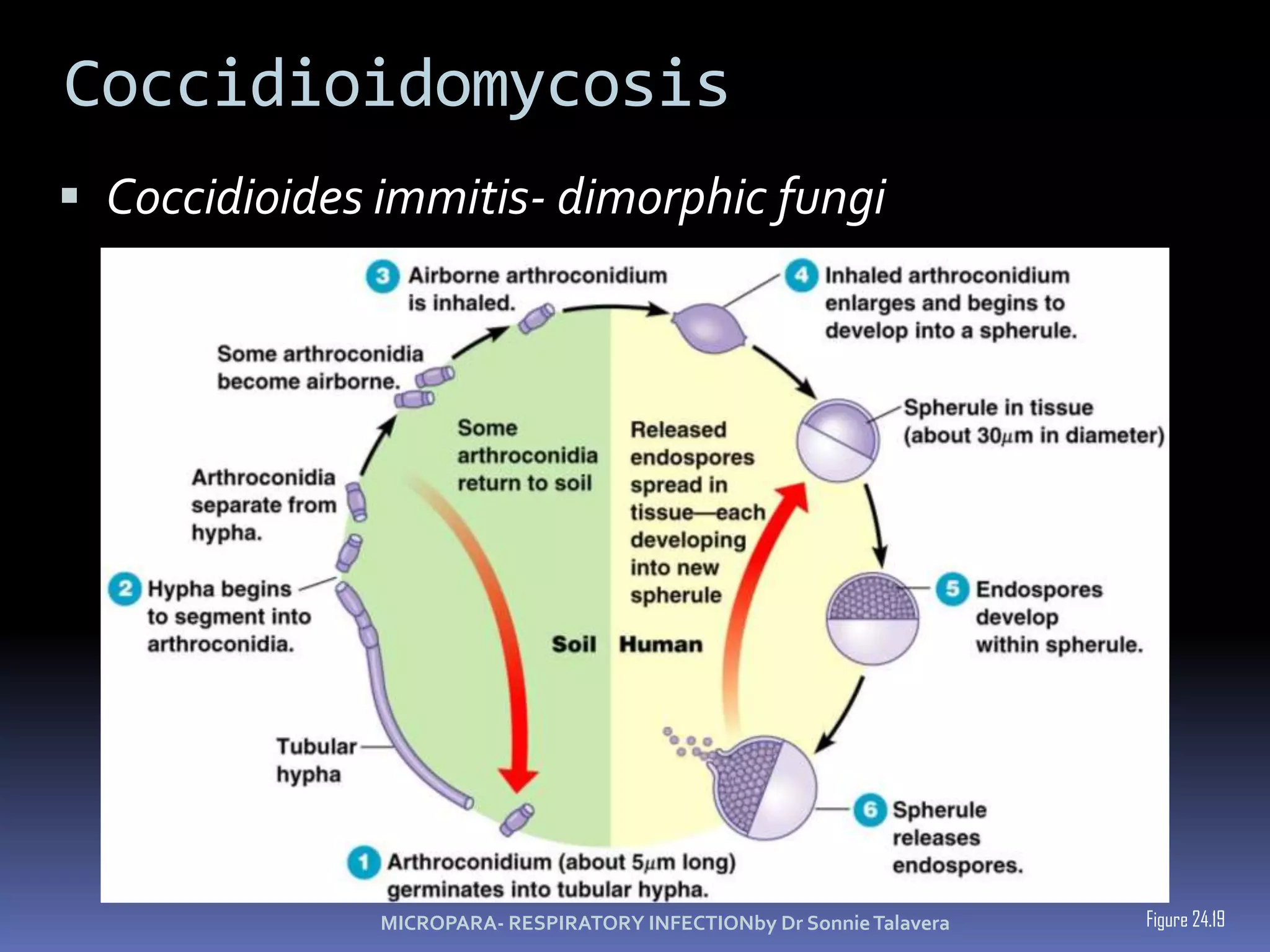InfluenzaHemagglutinin (H) spikes used for attachment to host cells.Neuraminidase (N) spikes used to release virus from cell.Figure 24.16MICROPARA- RESPIRATORY INFECTIONby Dr Sonnie Talavera