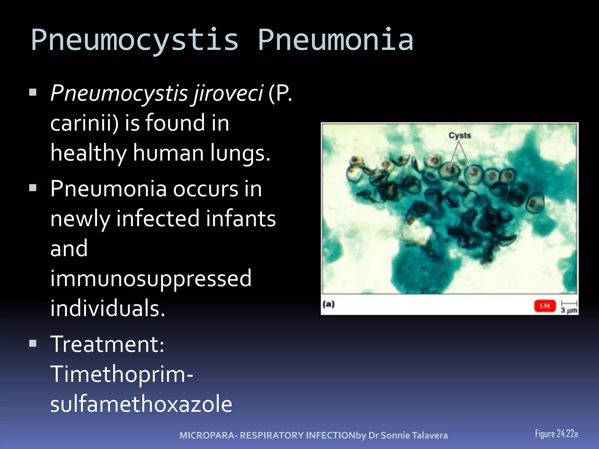 Influenza Deaths during epidemic - secondary bacterial infections.Multivalent vaccines for the elderly and other high-risk groups.Amantadine and rimantadine are effective prophylactic and curative drugsZanamivir  and oseltamivirMICROPARA- RESPIRATORY INFECTIONby Dr Sonnie Talavera