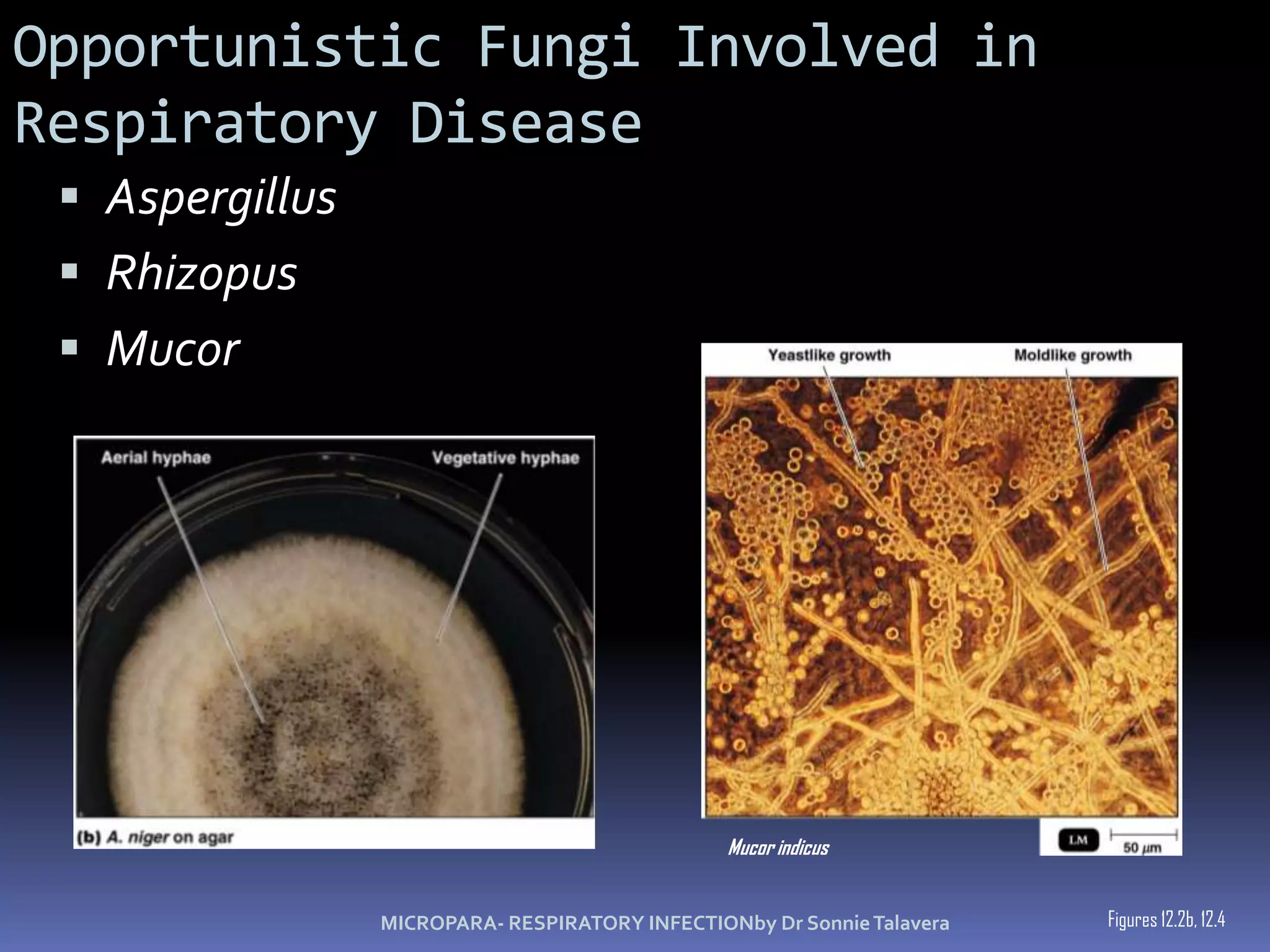 Rex Karl S. Teoxon, R.N, M.D157