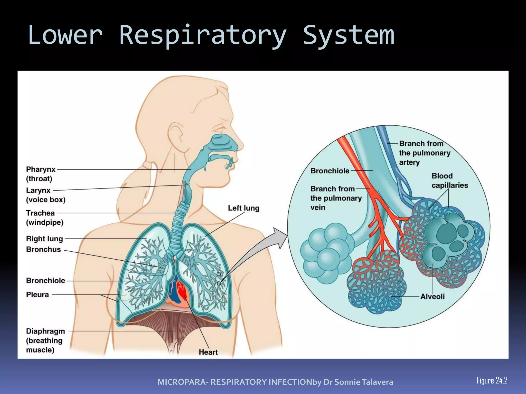 discomfort - pressure and blocked nasal passagesCommon coldRhinoviruses (50%)Coronaviruses (15-20%)MICROPARA- RESPIRATORY INFECTIONby Dr Sonnie Talavera