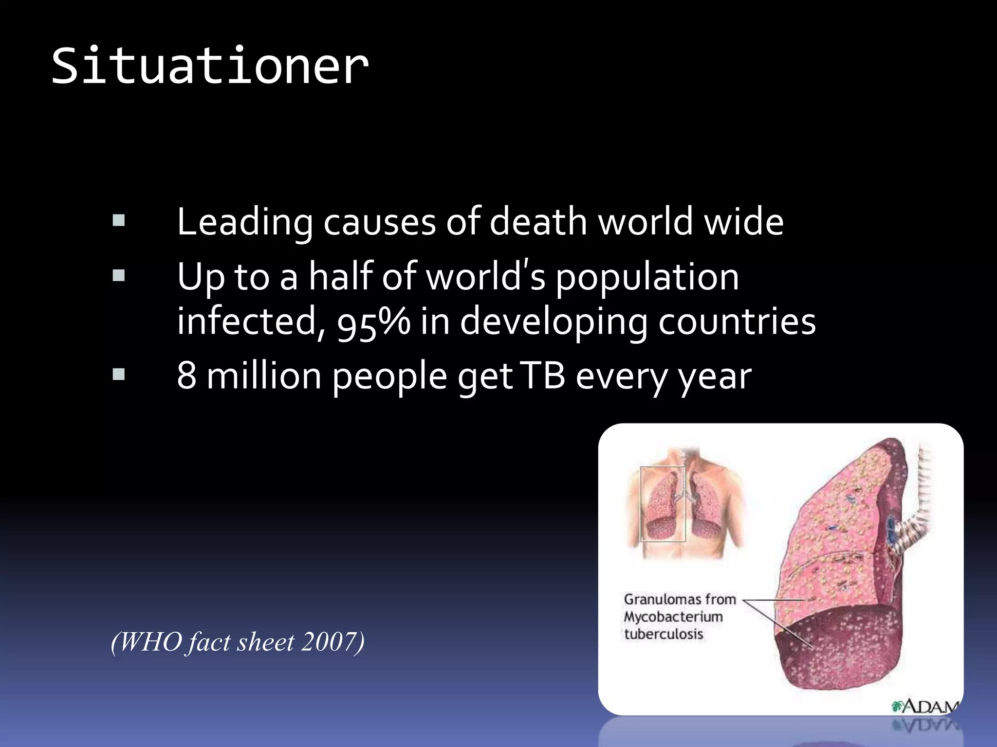 Pertussis (Whooping Cough)MICROPARA- RESPIRATORY INFECTIONby Dr Sonnie Talavera