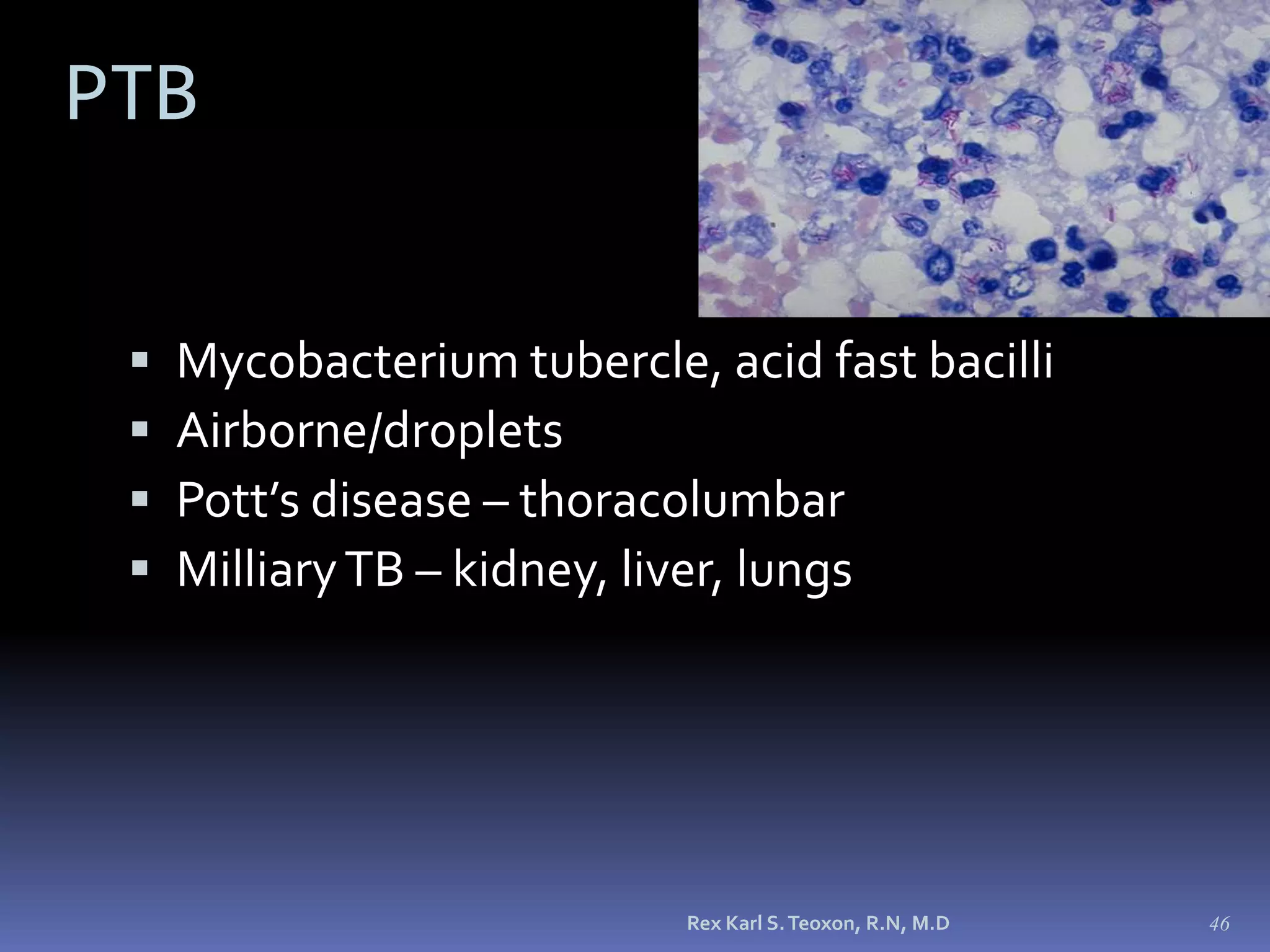 Clinical Progression of Pertussis,or deathInflammation of respiratory mucosal memb.Most infectious, but generally not yet diagnosed