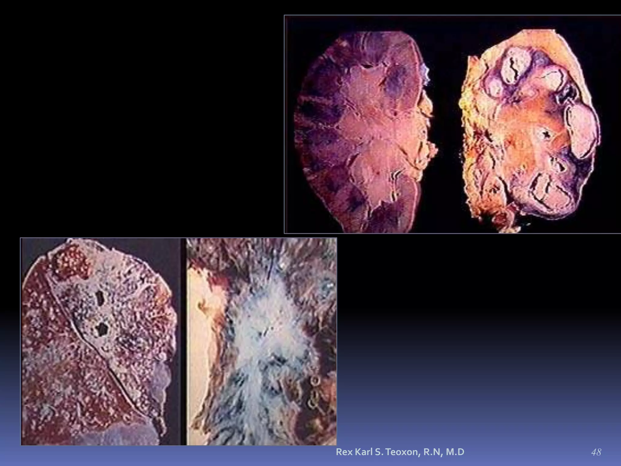 Fastidious and slow-growing