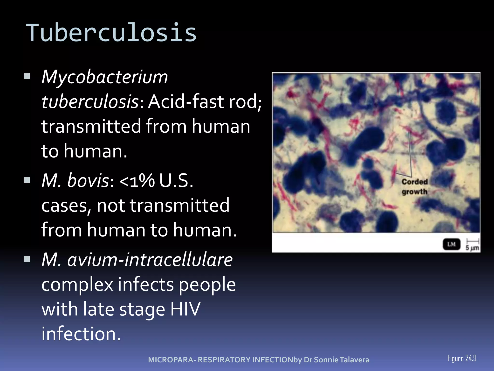 Tuberculosis