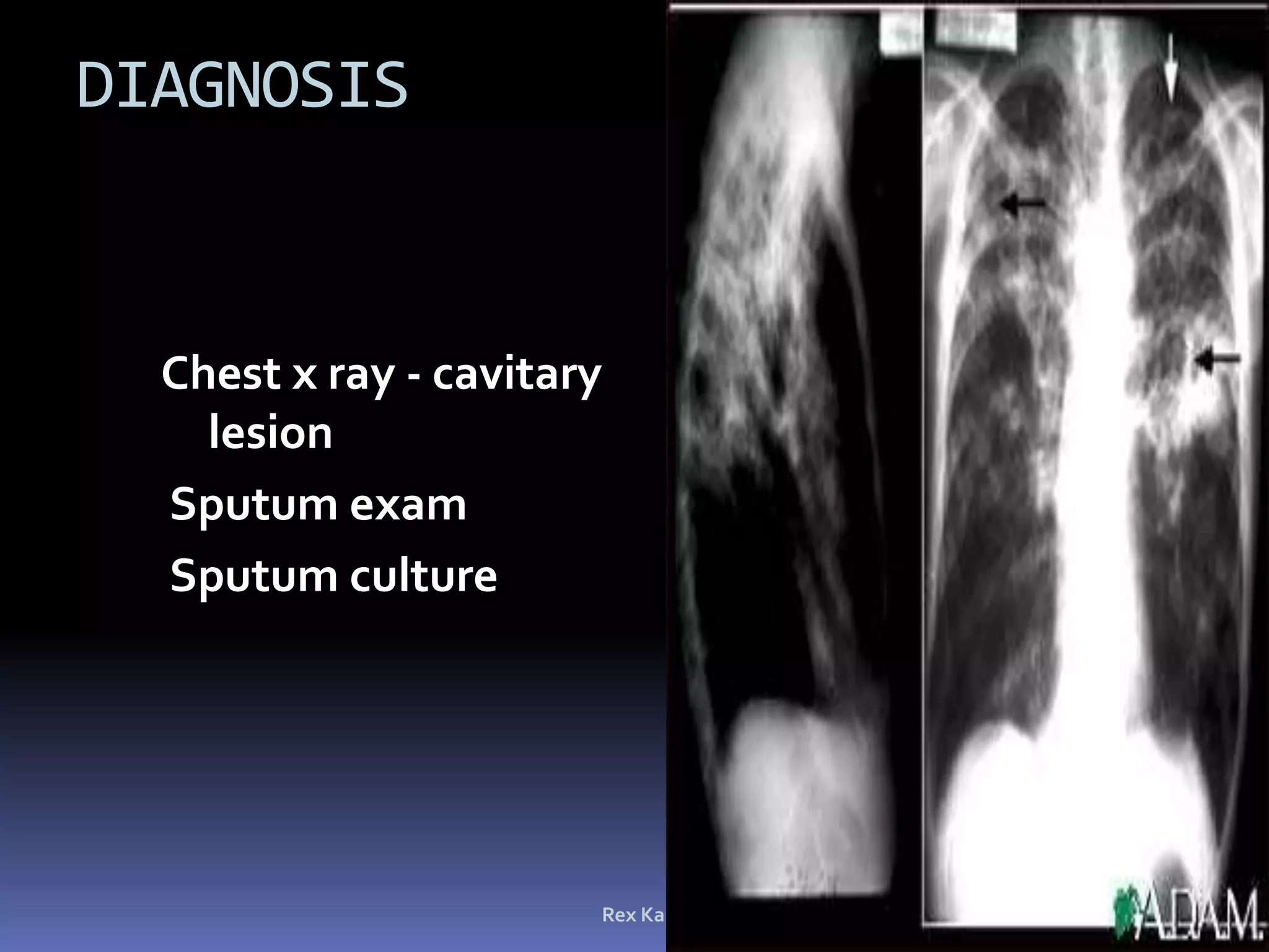 Rex Karl S. Teoxon, R.N, M.D47