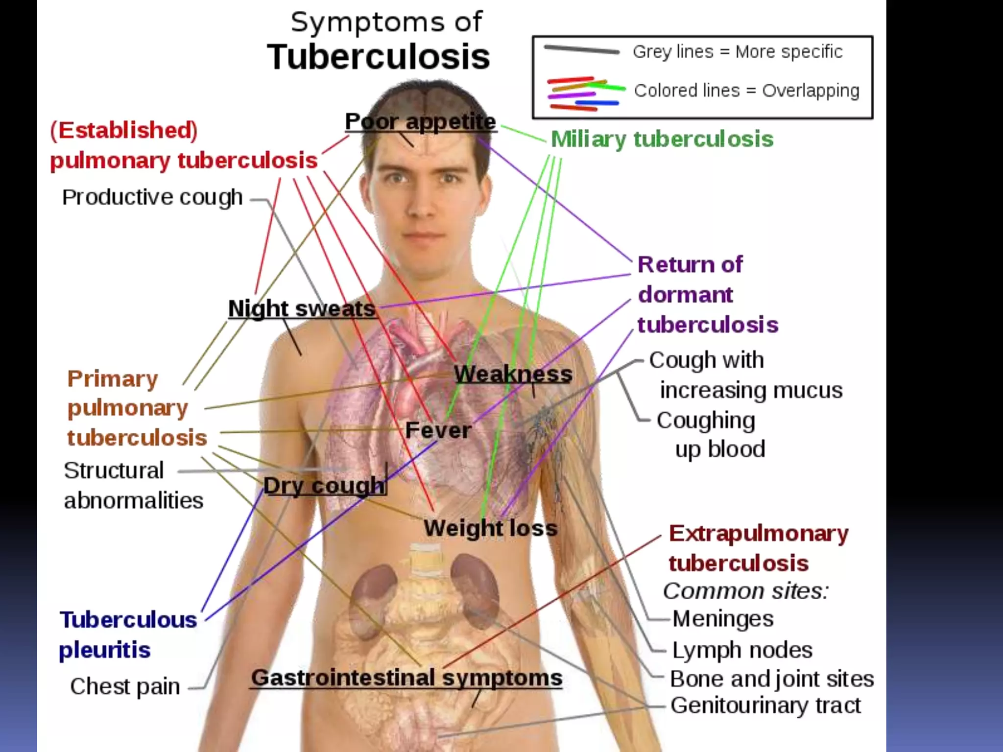 BacteriophageRex Karl S. Teoxon, R.N, M.D56PPD – IDmacrophages in skin take up Ag and deliver it to T cells    T cells move to skin site, release lymphokines     activate macrophages and in 48-72 hrs, skin becomes indurated - > 10 mm is (+) 