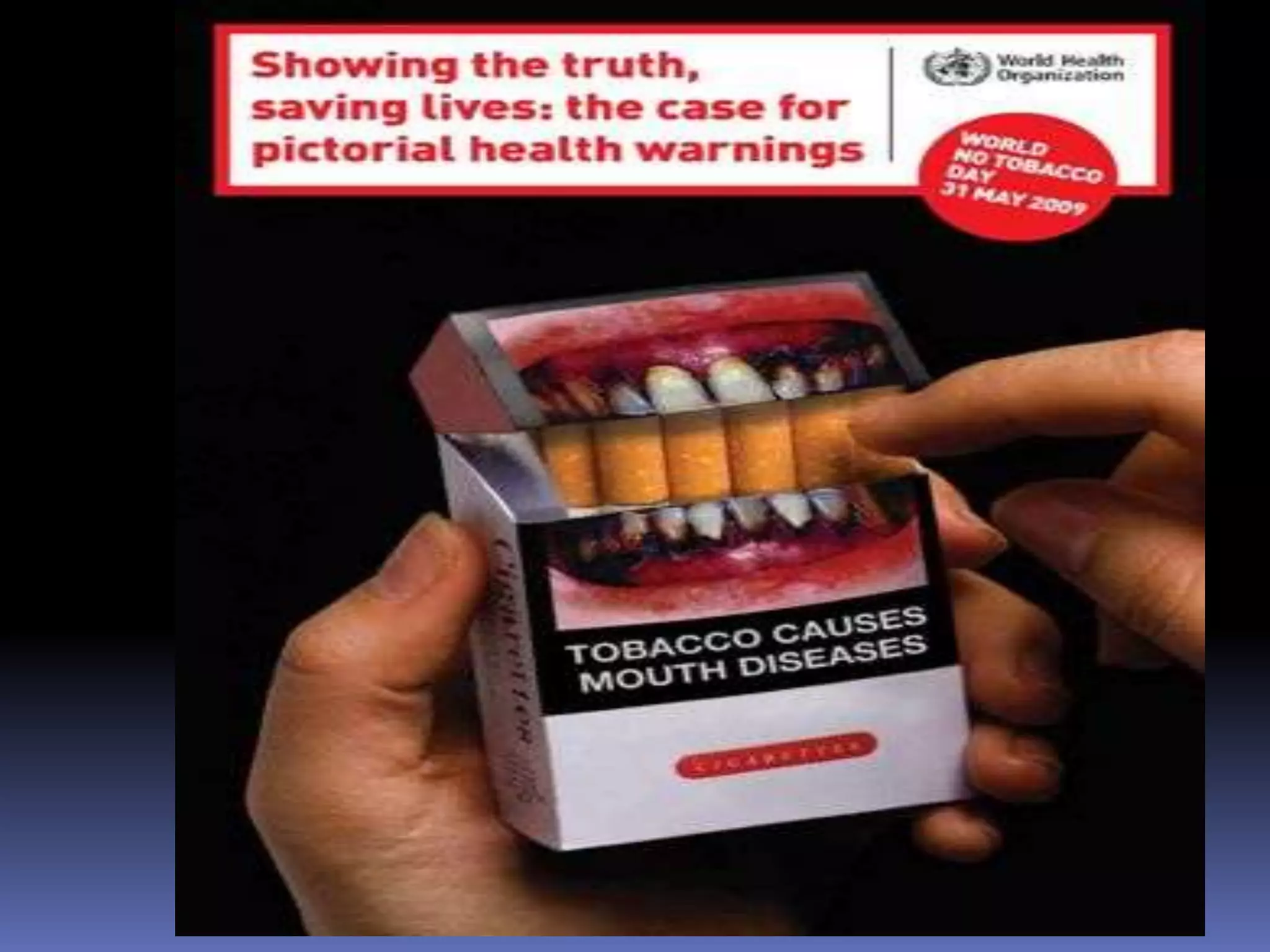 Stages of diseasePrimary infectionAsymptomatic to flu-like3-5% develop TBTubercle (granulomatous response)Reactivation (active TB) Years later, 10% experienceLRT disease (pneumonia)Disseminated miliary TBAlmost everywhereAIDS and antibiotic resistance