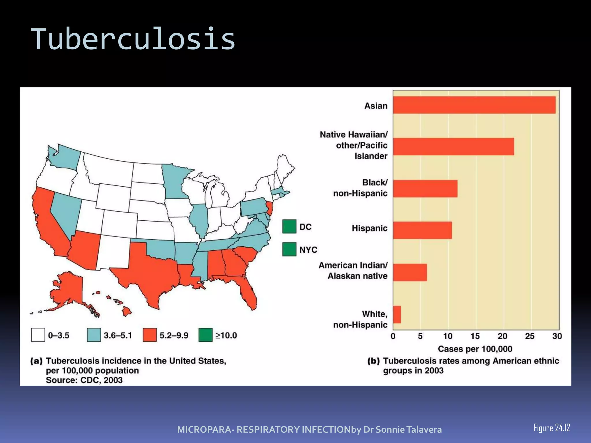 Tuberculosis Lesions formed by M. tuberculosis are called tuberclesDead macrophages and bacteria form the caseous lesion that might calcify and appear in an X ray as a Ghon’s complex.MICROPARA- RESPIRATORY INFECTIONby Dr Sonnie Talavera