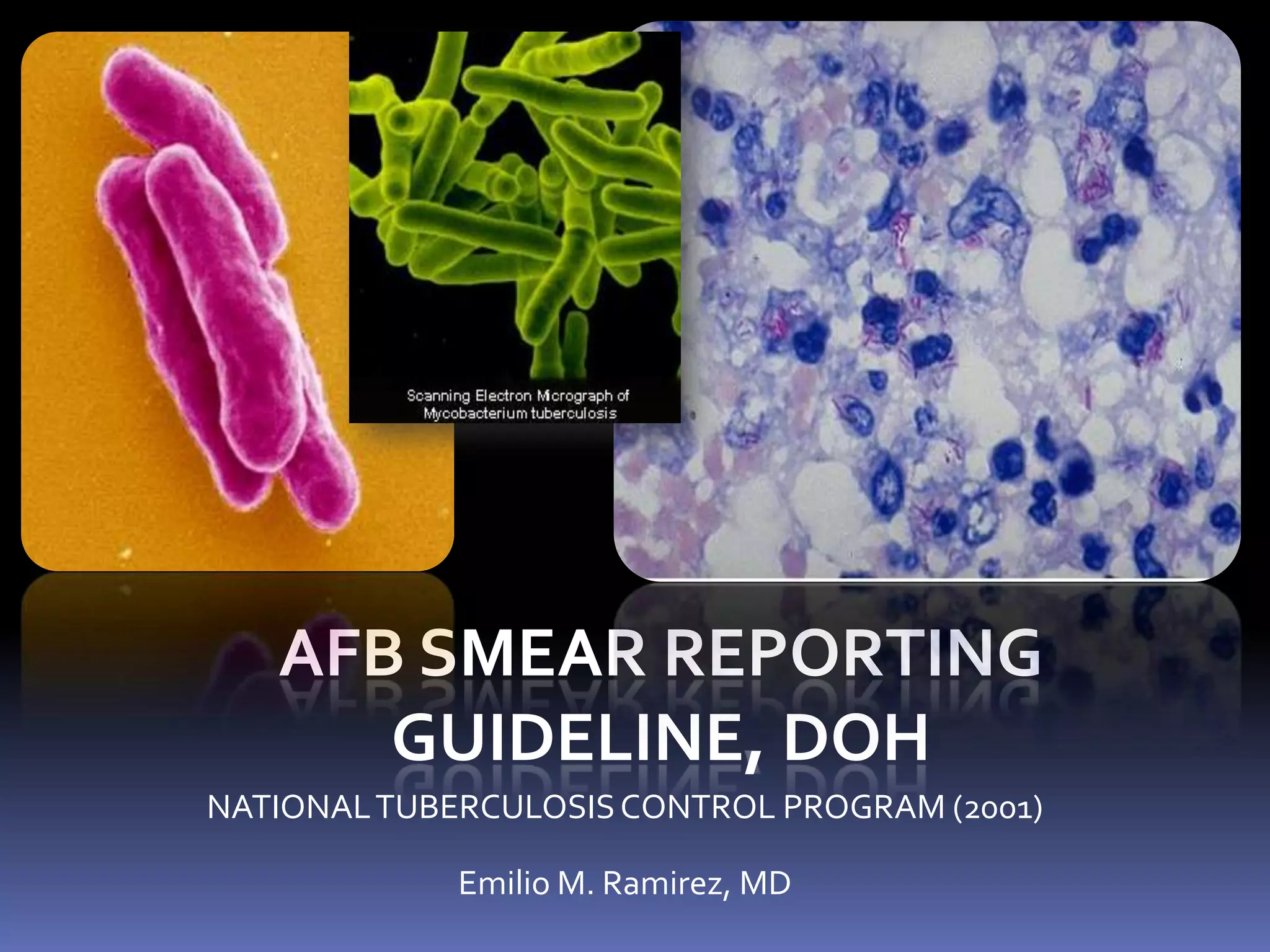Tuberculosis Positive tuberculin skin test an active case of TBprior infectionvaccination immunity to the diseaseInduration and reddening at inoculation site within 48hours.Most accurate- Mantoux testMICROPARA- RESPIRATORY INFECTIONby Dr Sonnie Talavera