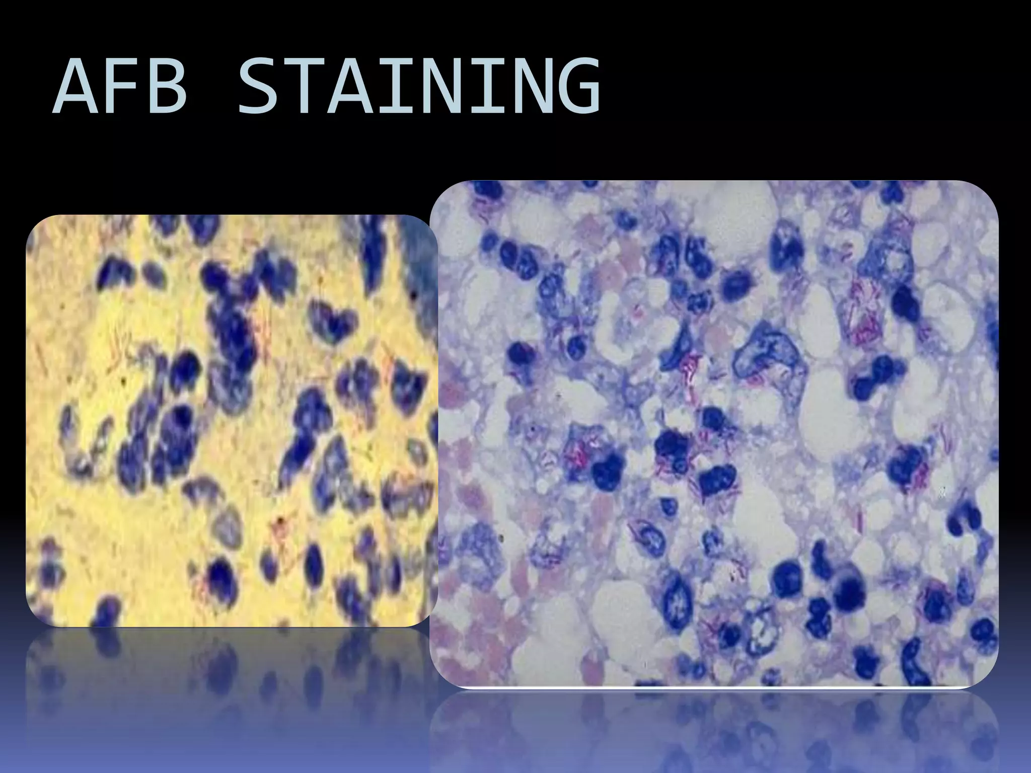 Tuberculosis Mycobacterium boviscauses bovine tuberculosis transmitted to humans by unpasteurized milk.affect the bones or lymphatic system.BCG vaccine -a live, avirulent culture of M. bovisM. avium-intracellulare complex infects patients in the late stages of HIVMICROPARA- RESPIRATORY INFECTIONby Dr Sonnie Talavera