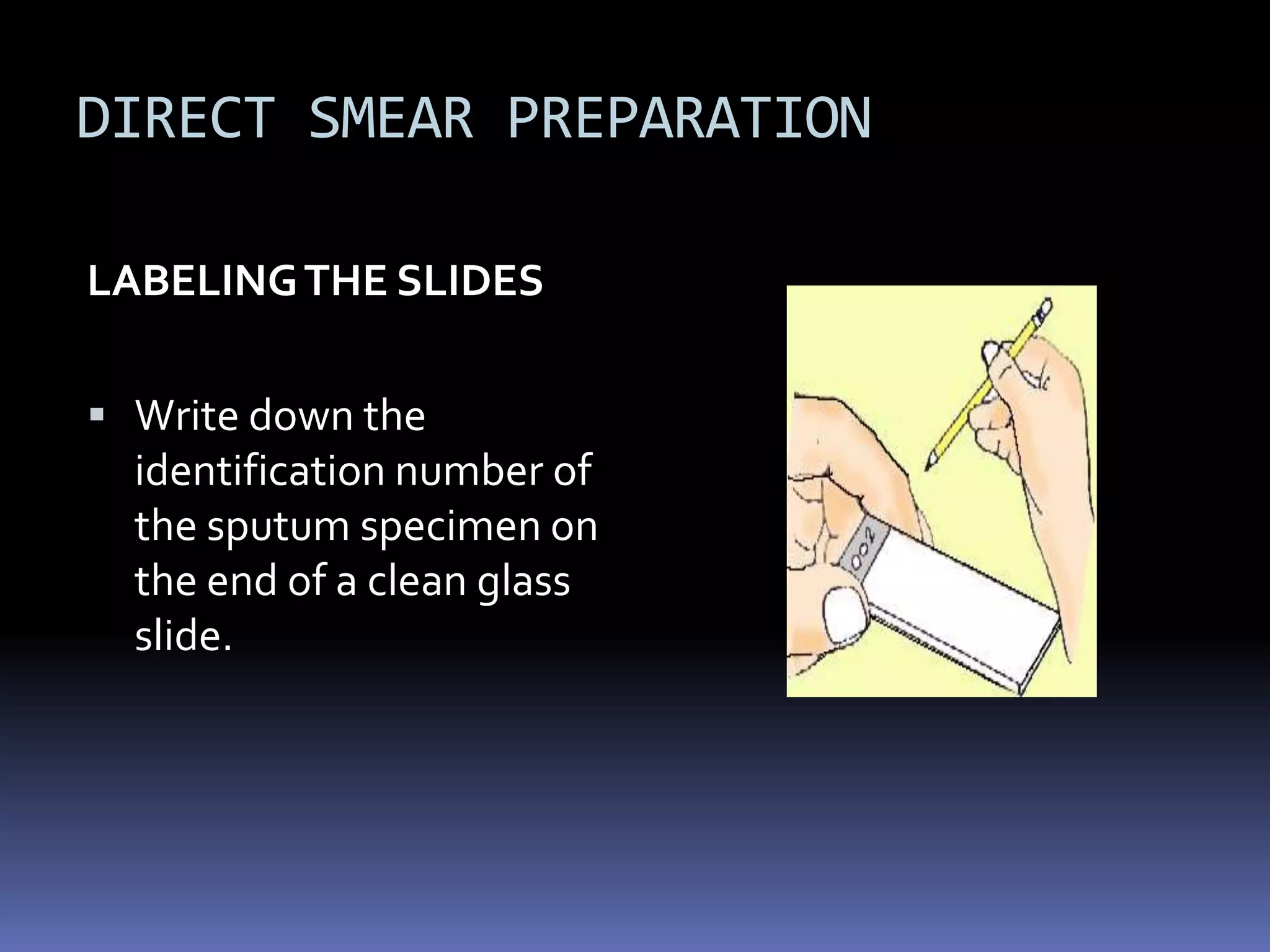 TuberculosisFigure 24.12MICROPARA- RESPIRATORY INFECTIONby Dr Sonnie Talavera
