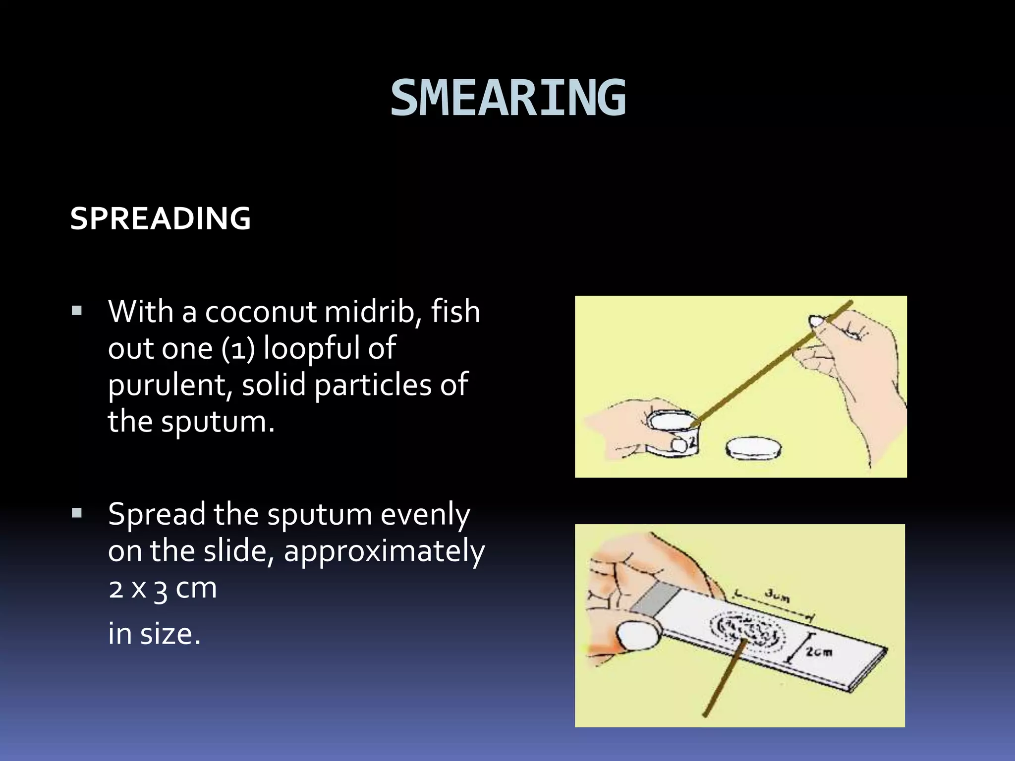 Rex Karl S. Teoxon, R.N, M.D78MANAGEMENTshort course – 6-9 months long course – 9-12 monthsDOTS- direct observe treatment short courseCase findingHome meds (members of the family)ReferralsFollow-up short course – 6-9 months long course – 9-12 months